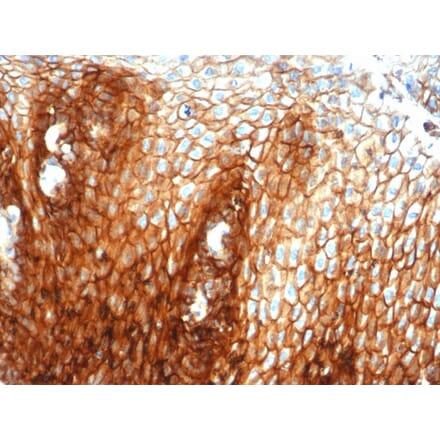 Immunohistochemistry - Anti-CD44 Antibody [HCAM/6459R] (A250725) - Antibodies.com
