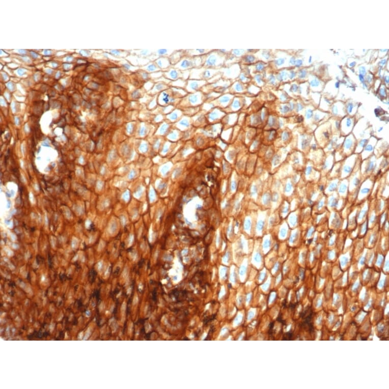 Immunohistochemistry - Anti-CD44 Antibody [HCAM/6459R] (A250725) - Antibodies.com