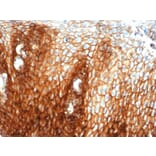 Immunohistochemistry - Anti-CD44 Antibody [HCAM/6459R] (A250725) - Antibodies.com