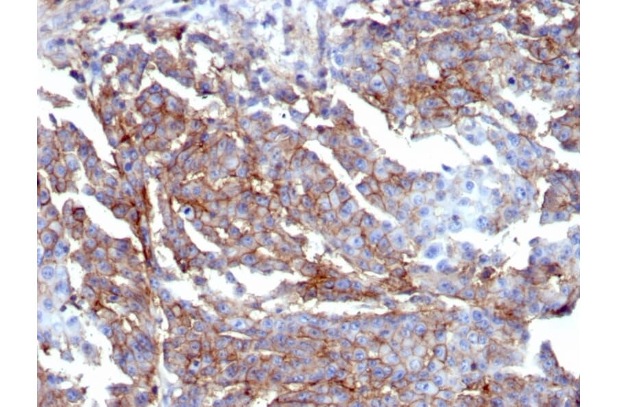 Immunohistochemistry - Anti-CD44 Antibody [HCAM/6459R] (A250724) - Antibodies.com