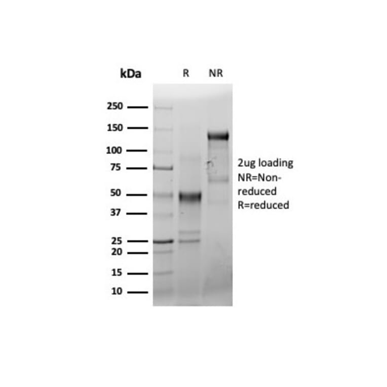 SDS-PAGE - Anti-CD44 Antibody [HCAM/6459R] (A250725) - Antibodies.com