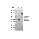 SDS-PAGE - Anti-CD44 Antibody [HCAM/6459R] (A250725) - Antibodies.com