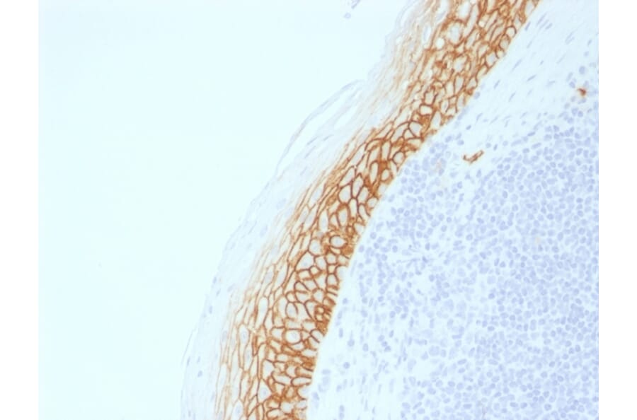 Immunohistochemistry - Anti-CD44v9 Antibody [CD44v9/2344R] (A250725) - Antibodies.com