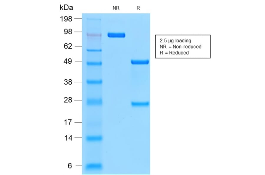 SDS-PAGE - Anti-CD44v9 Antibody [CD44v9/2344R] (A250726) - Antibodies.com