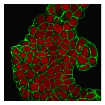 Immunofluorescence - Anti-CD47 Antibody [B6H12.2] (A250728) - Antibodies.com