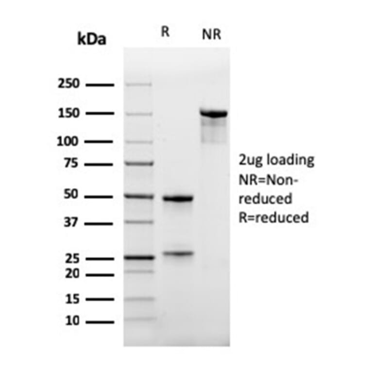SDS-PAGE - Anti-CD47 Antibody [IAP/964] (A250729) - Antibodies.com