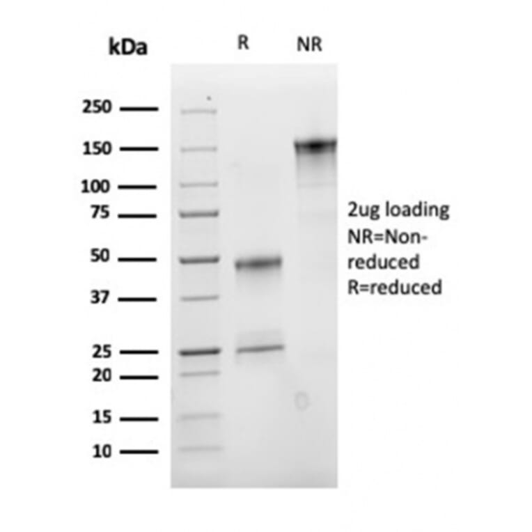 SDS-PAGE - Anti-CD47 Antibody [CD47/2937] (A250731) - Antibodies.com