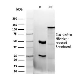 SDS-PAGE - Anti-CD47 Antibody [CD47/6362R] (A250733) - Antibodies.com