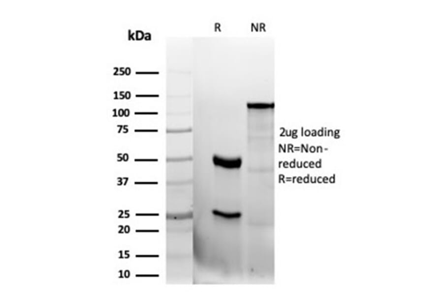 SDS-PAGE - Anti-CD47 Antibody [CD47/6362R] (A250733) - Antibodies.com