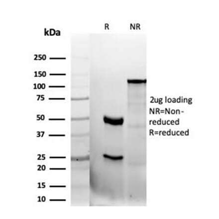 SDS-PAGE - Anti-CD47 Antibody [CD47/6362R] (A250733) - Antibodies.com