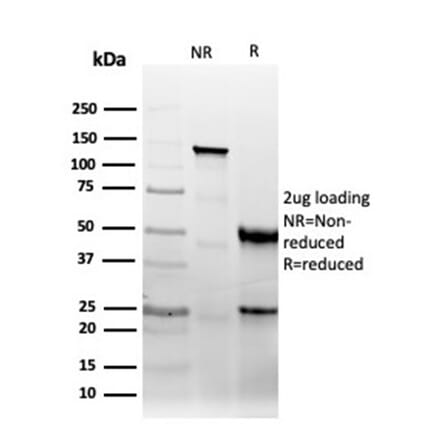 SDS-PAGE - Anti-CD47 Antibody [CD47/6364R] (A250734) - Antibodies.com