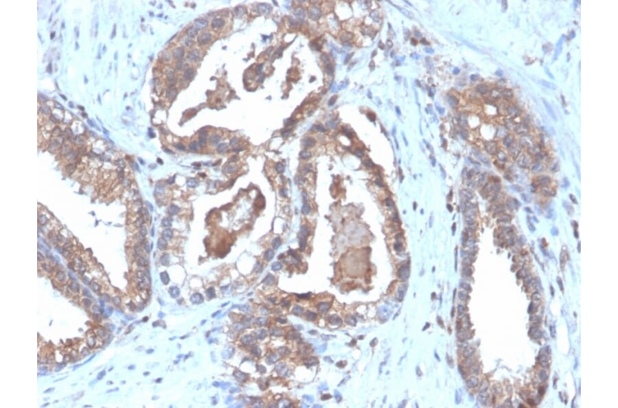Immunohistochemistry - Anti-CD47 Antibody [CD47/6364R] (A250733) - Antibodies.com
