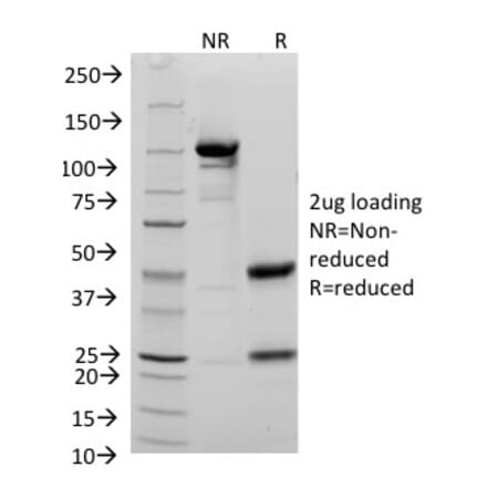SDS-PAGE - Anti-CD48 Antibody [156-4H9] (A250734) - Antibodies.com