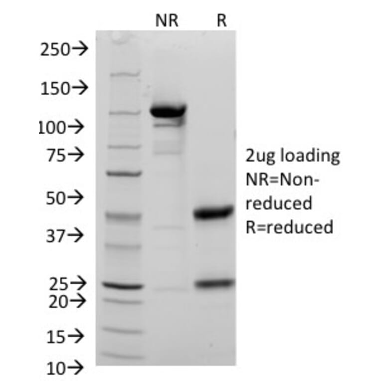SDS-PAGE - Anti-CD48 Antibody [156-4H9] (A250734) - Antibodies.com