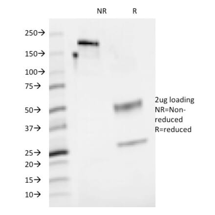 SDS-PAGE - Anti-CD48 Antibody [5-4.8] (A250735) - Antibodies.com
