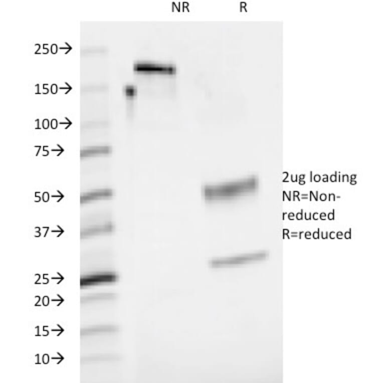 SDS-PAGE - Anti-CD48 Antibody [5-4.8] (A250735) - Antibodies.com