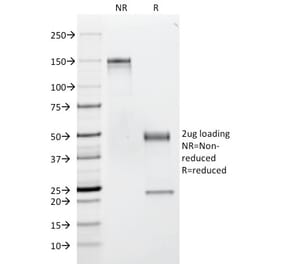SDS-PAGE - Anti-CD53 Antibody [63-5A3] (A250736) - Antibodies.com