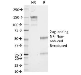 SDS-PAGE - Anti-CD53 Antibody [161-2] (A250737) - Antibodies.com