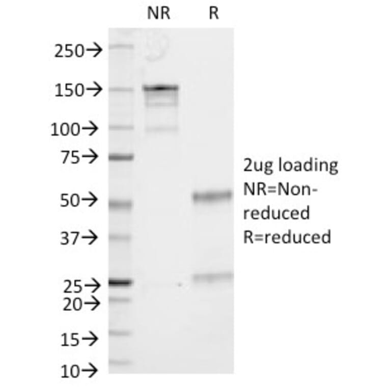 SDS-PAGE - Anti-CD53 Antibody [161-2] (A250737) - Antibodies.com
