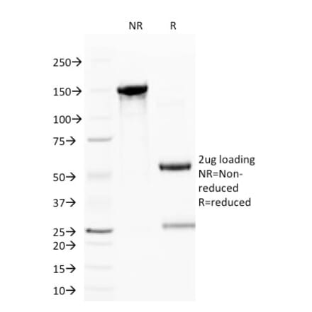 SDS-PAGE - Anti-CD59 Antibody [BRA-10G] (A250738) - Antibodies.com