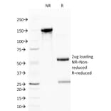 SDS-PAGE - Anti-CD59 Antibody [BRA-10G] (A250738) - Antibodies.com
