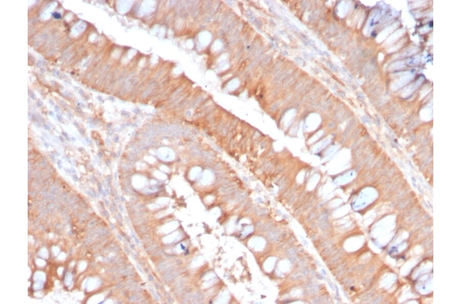 Immunohistochemistry - Anti-CD59 Antibody [MACIF/2867R] (A250741) - Antibodies.com