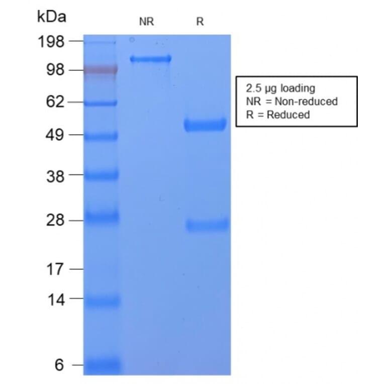 SDS-PAGE - Anti-CD59 Antibody [MACIF/2867R] (A250742) - Antibodies.com