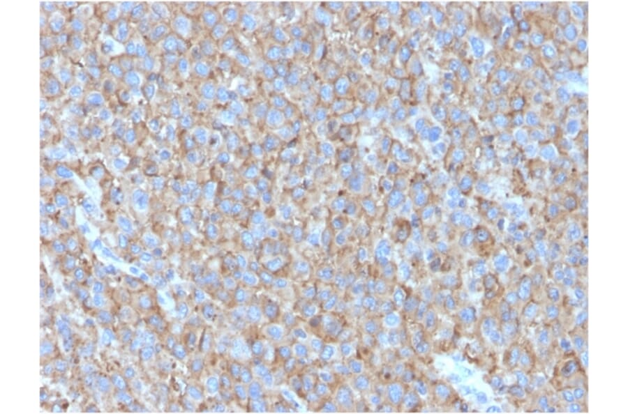 Immunohistochemistry - Anti-CD63 Antibody [LAMP3/2790] (A250743) - Antibodies.com