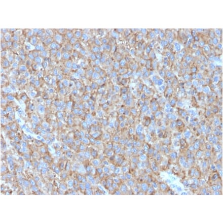 Immunohistochemistry - Anti-CD63 Antibody [LAMP3/2790] (A250743) - Antibodies.com