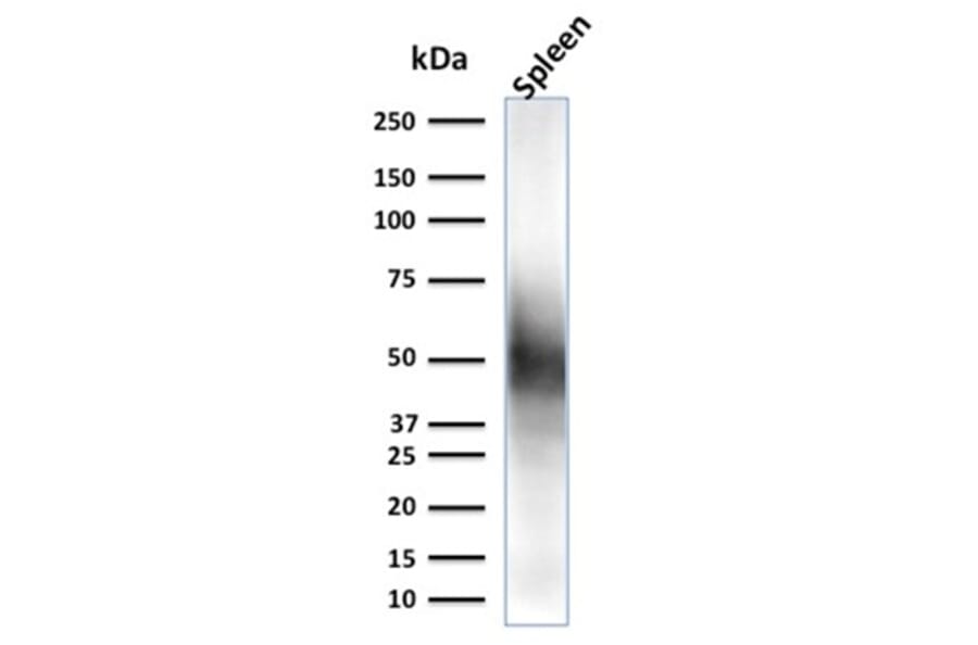 Western Blot - Anti-CD63 Antibody [LAMP3/2790] (A250743) - Antibodies.com