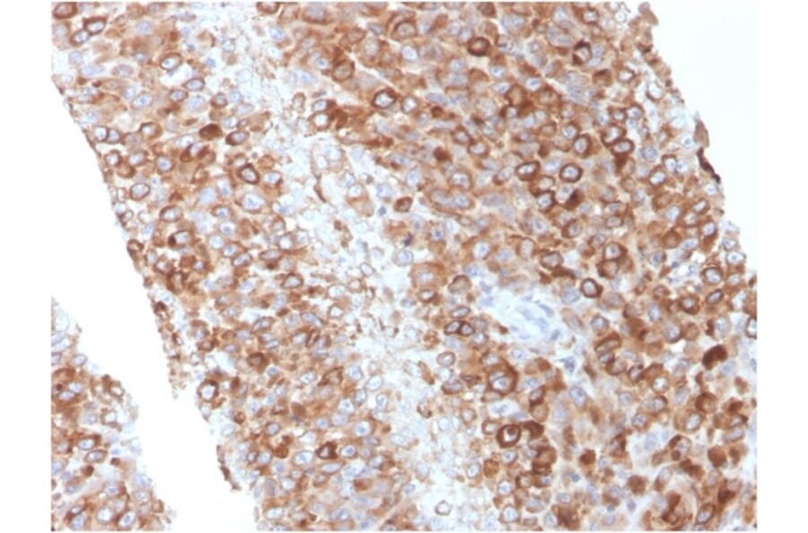 Immunohistochemistry - Anti-CD63 Antibody [LAMP3/2881] (A250744) - Antibodies.com