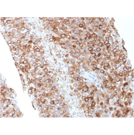 Immunohistochemistry - Anti-CD63 Antibody [LAMP3/2881] (A250744) - Antibodies.com