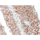Immunohistochemistry - Anti-CD63 Antibody [LAMP3/2881] (A250744) - Antibodies.com