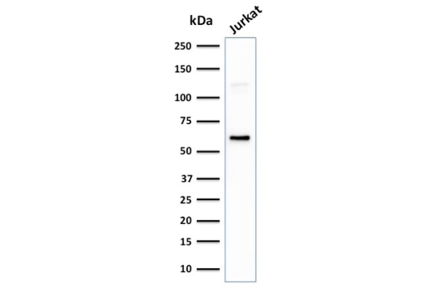 Western Blot - Anti-CD63 Antibody [LAMP3/2881] (A250744) - Antibodies.com