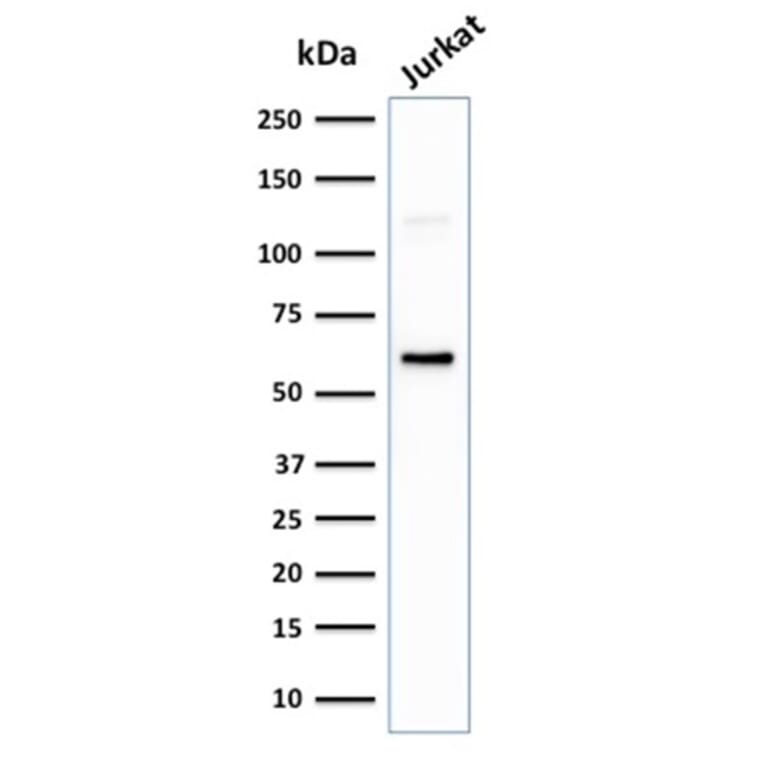 Western Blot - Anti-CD63 Antibody [LAMP3/2881] (A250744) - Antibodies.com