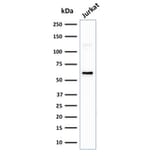 Western Blot - Anti-CD63 Antibody [LAMP3/2881] (A250744) - Antibodies.com