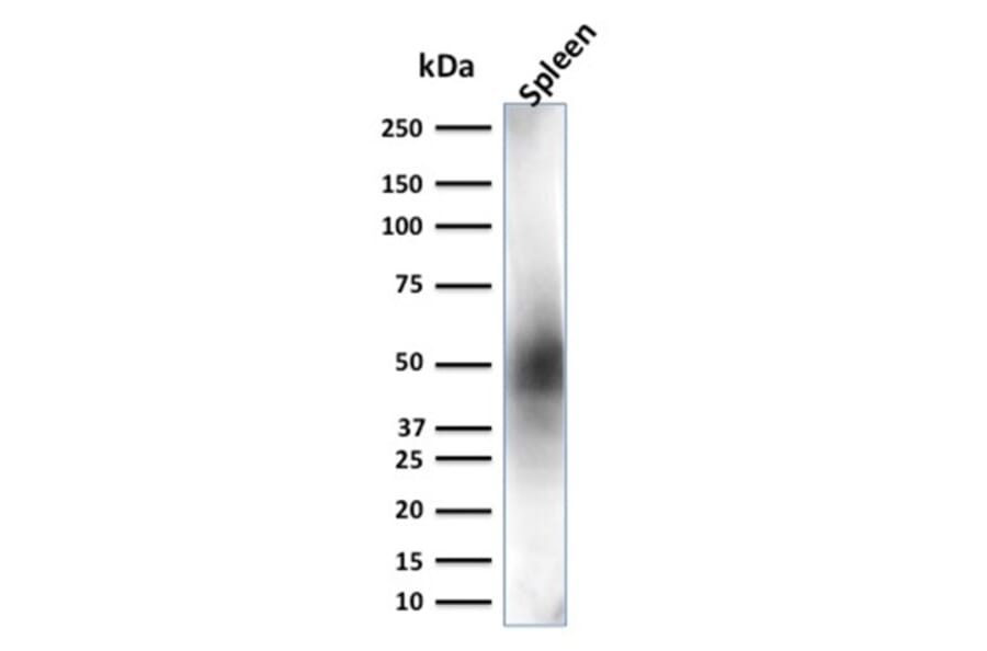 Western Blot - Anti-CD63 Antibody [LAMP3/2881] (A250744) - Antibodies.com