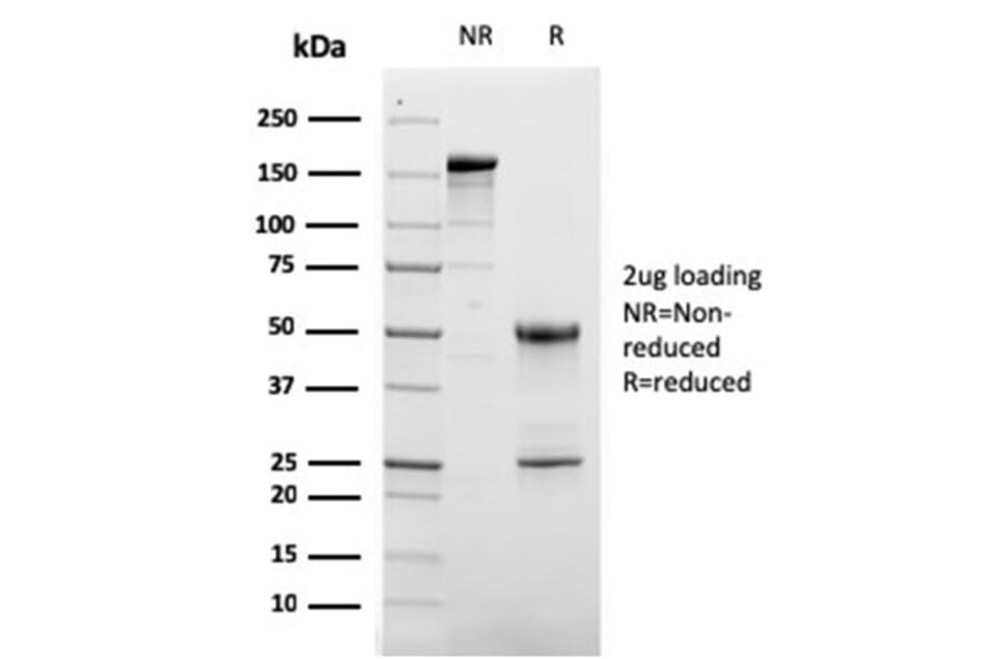 SDS-PAGE - Anti-CD63 Antibody [LAMP3/2881] (A250744) - Antibodies.com