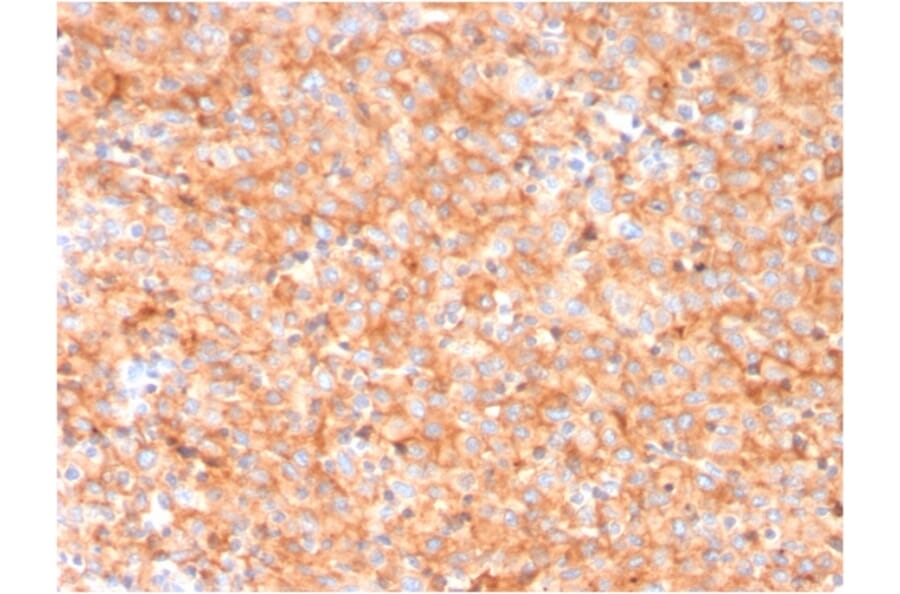 Immunohistochemistry - Anti-CD63 Antibody [LAMP3/3315] (A250745) - Antibodies.com