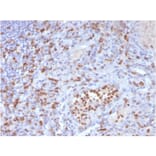 Immunohistochemistry - Anti-CD63 Antibody [LAMP3/3315] (A250745) - Antibodies.com