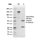 SDS-PAGE - Anti-CD63 Antibody [LAMP3/3315] (A250745) - Antibodies.com
