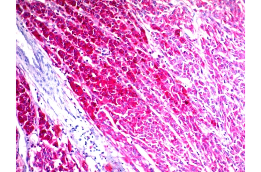 Immunohistochemistry - Anti-CD63 Antibody [NKI/C3] (A250746) - Antibodies.com