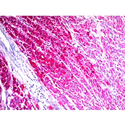 Immunohistochemistry - Anti-CD63 Antibody [NKI/C3] (A250746) - Antibodies.com
