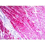 Immunohistochemistry - Anti-CD63 Antibody [NKI/C3] (A250746) - Antibodies.com