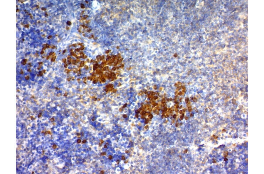 Immunohistochemistry - Anti-CD63 Antibody [NKI/C3] (A250746) - Antibodies.com