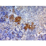 Immunohistochemistry - Anti-CD63 Antibody [NKI/C3] (A250746) - Antibodies.com