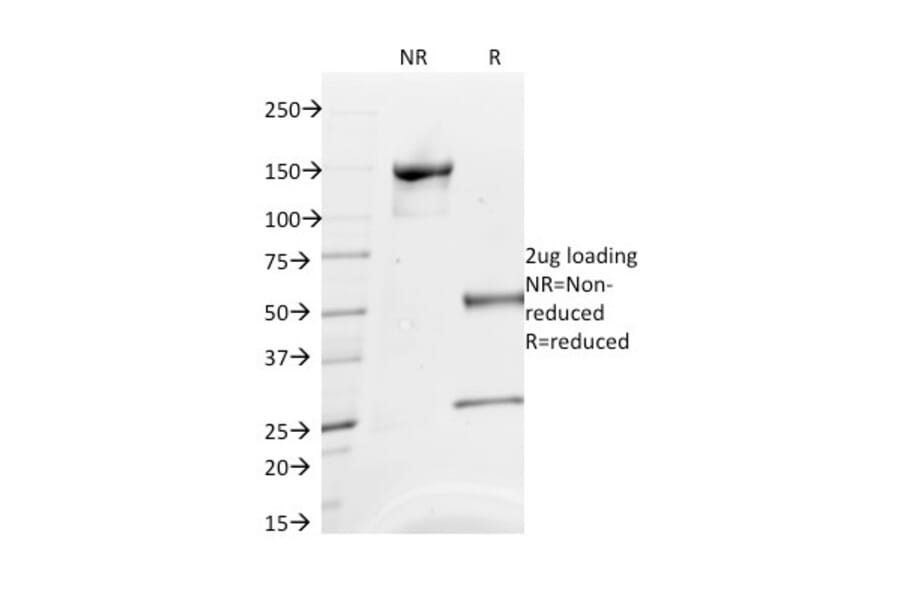SDS-PAGE - Anti-CD63 Antibody [NKI/C3] (A250746) - Antibodies.com