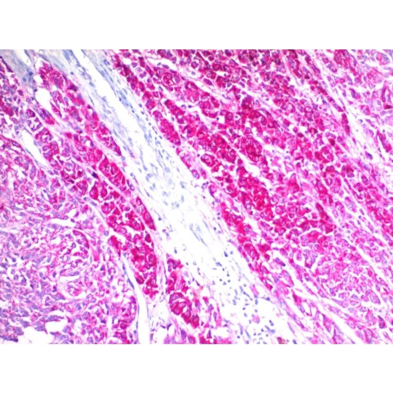 Immunohistochemistry - Anti-CD63 Antibody [SPM524] (A250746) - Antibodies.com