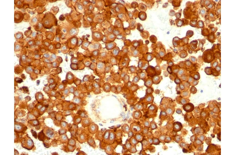 Immunohistochemistry - Anti-CD63 Antibody [MX-49.129.5] (A250748) - Antibodies.com
