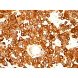 Immunohistochemistry - Anti-CD63 Antibody [MX-49.129.5] (A250748) - Antibodies.com